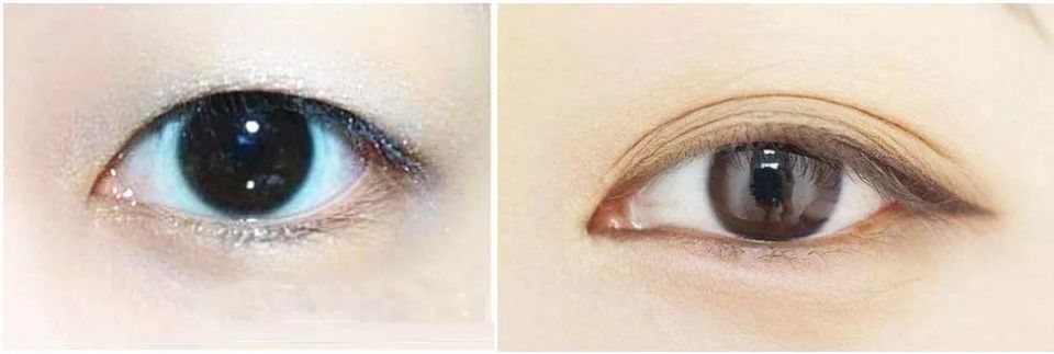 双眼皮“黄金不败宽度”来了!某璐要是早看到也不至于割完眼皮又