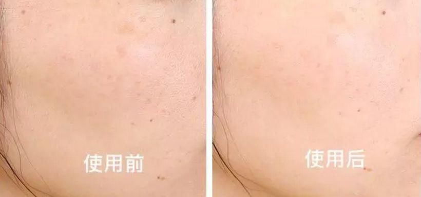 张韶涵又双叒叕种草了!10秒洗出角质、死皮，温和去角质...