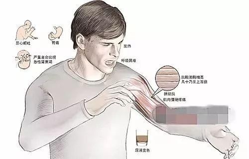 【辟谣专区】网传“吃小龙虾易患哈夫病” 专家表示:概率很低，结