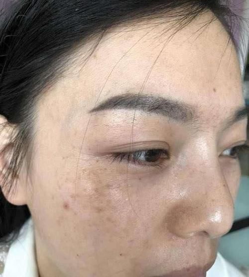  [白淡斑]西红柿与“它”搭配，美白淡斑又嫩肤，坚持两周，皮肤又白又水润