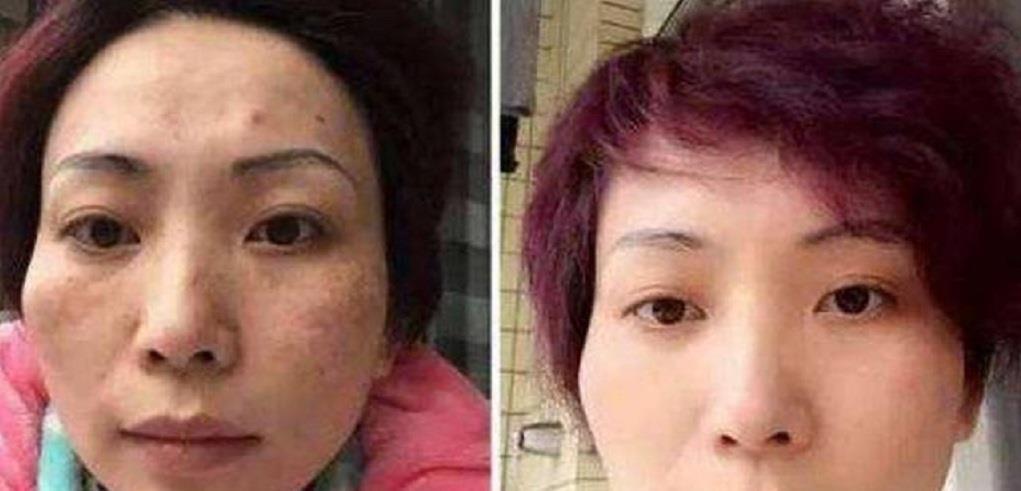 白皙■白醋加“它”来敷脸,7天淡化色斑又美白,轻松get白皙光洁肌肤