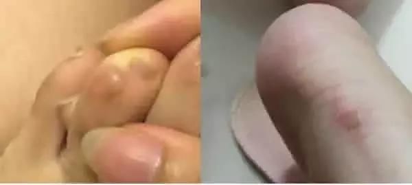 看完穿高更鞋的脚，你还敢那么爱高跟鞋吗？