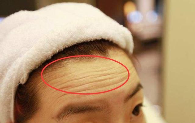  【保养】别管男女,如果脖子出现这种情况,该注意保养啦,别总是不当回事