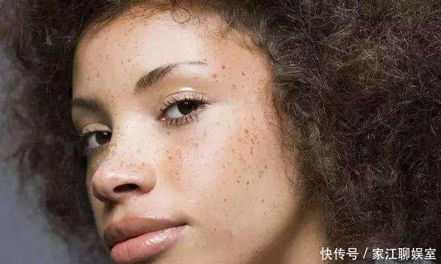  【加上】蜂蜜加上常见的“它”敷脸，15天快速淡斑美白，皮肤白皙又水嫩