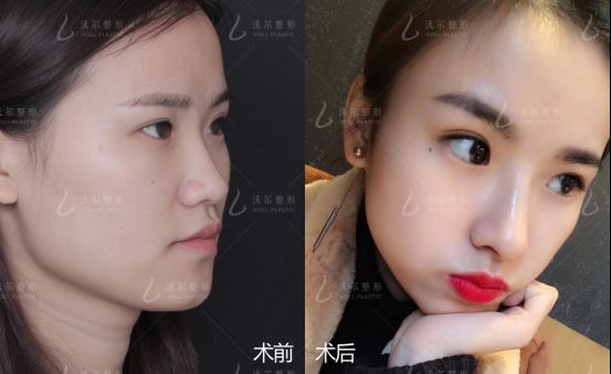 整形界女超人,14年磨砺与美同行-北京沃尔整形冯雁平