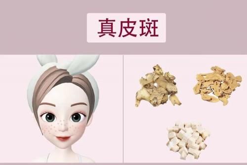  预防：脸上的斑点是如何形成的？看看这4种你有没有，最后一种可预防