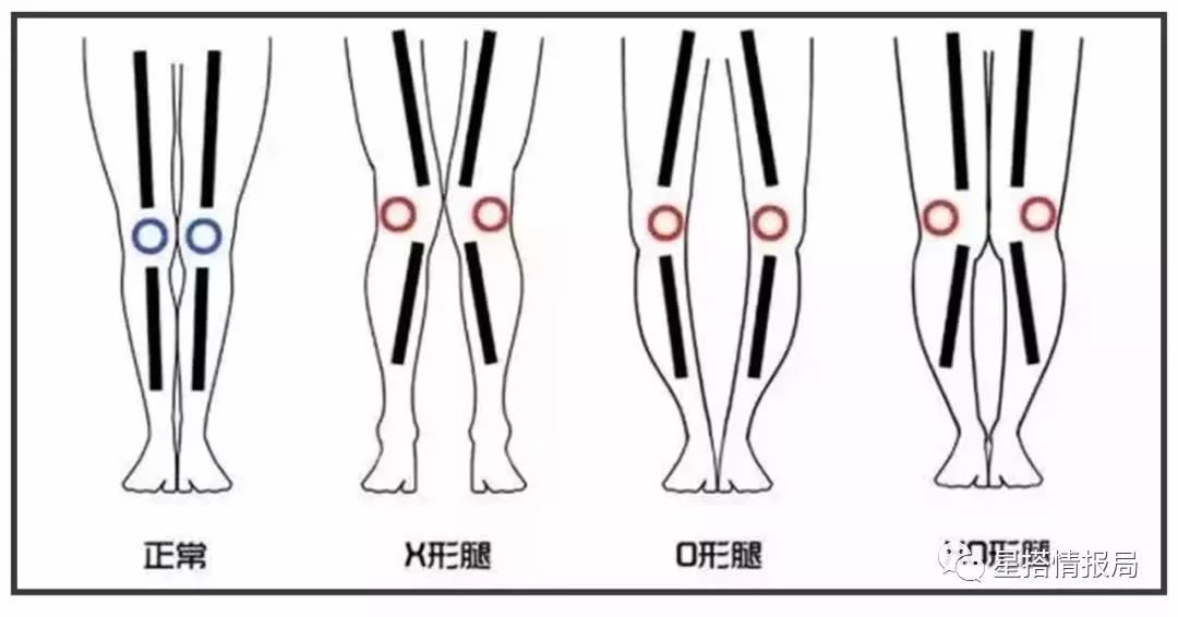终极O型腿林允儿是怎样用一条裤子把腿弄直的