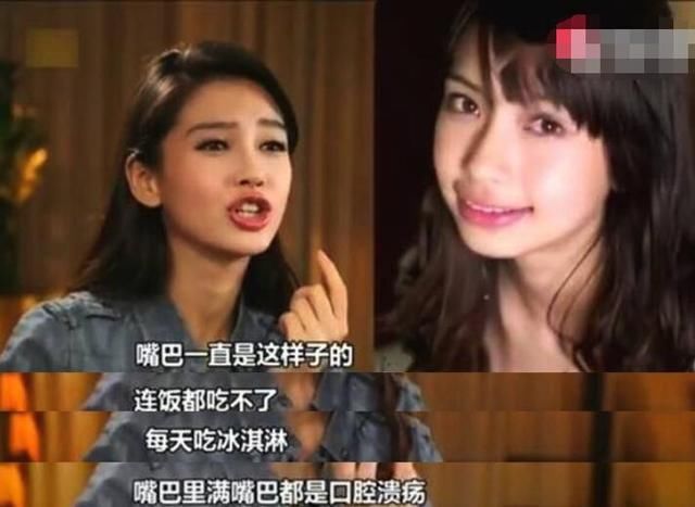 丁香医生拆台高晓松：拔牙不会让脸变小，那杨颖杨幂是怎么回事？