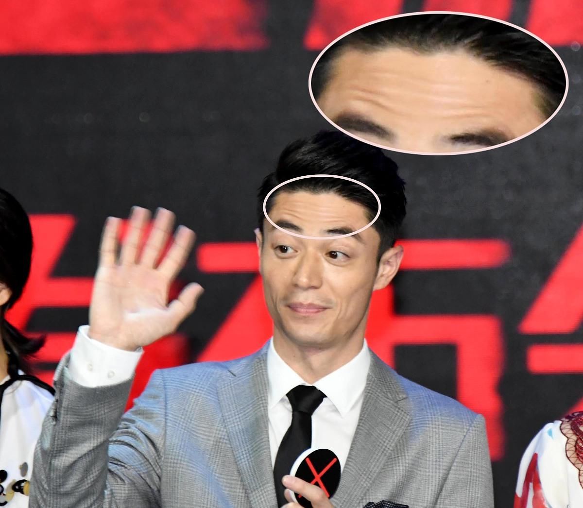  『皮肤』年纪轻轻就有了皱纹，为啥？请自查下，这些原因，你平时可曾注意
