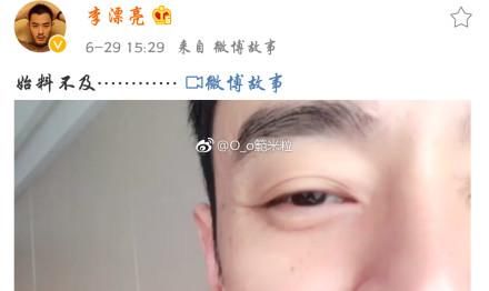男星尴尬部位被蚊子咬后，导致整个剧组停工，网友：想上手摸一把