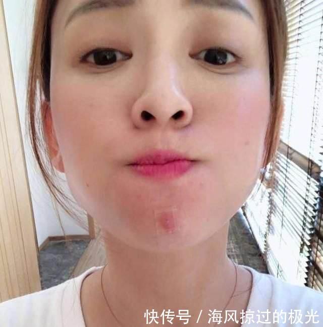「为皮肤」容易让皮肤变差的4种错误做法,据说很多人都在犯,难怪皮肤差!