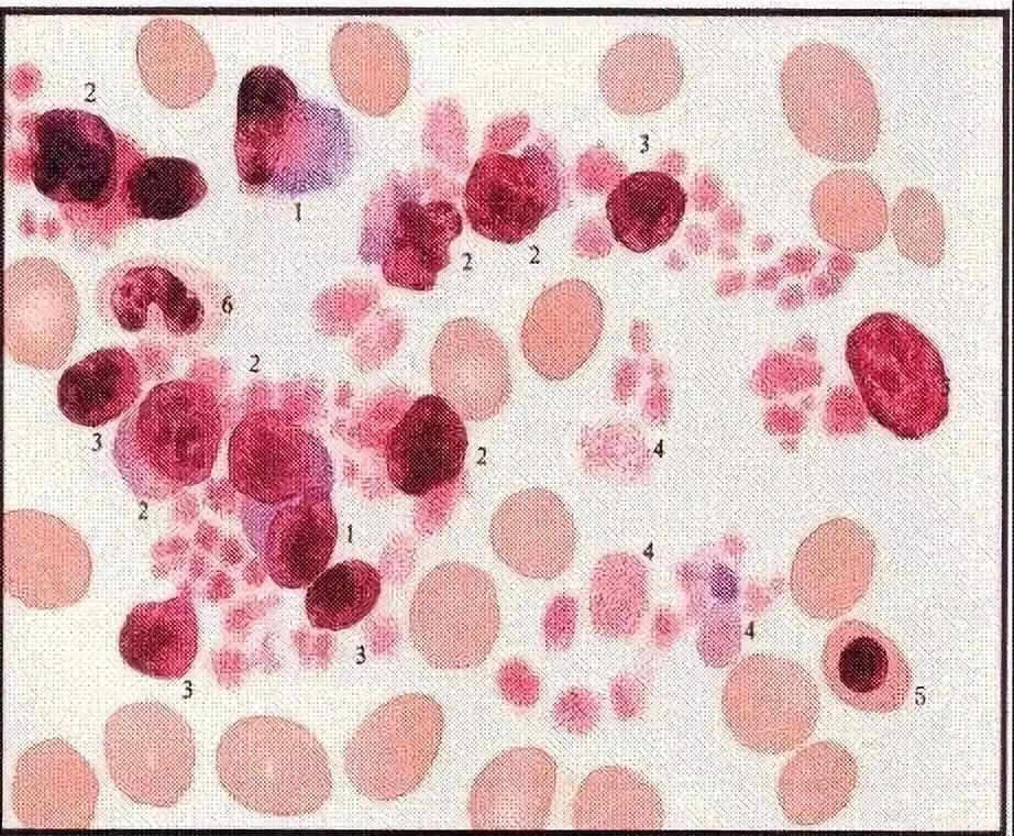 “妇幼保健院”发布紧急通知:这些儿童饮料致白血病?真相在这!