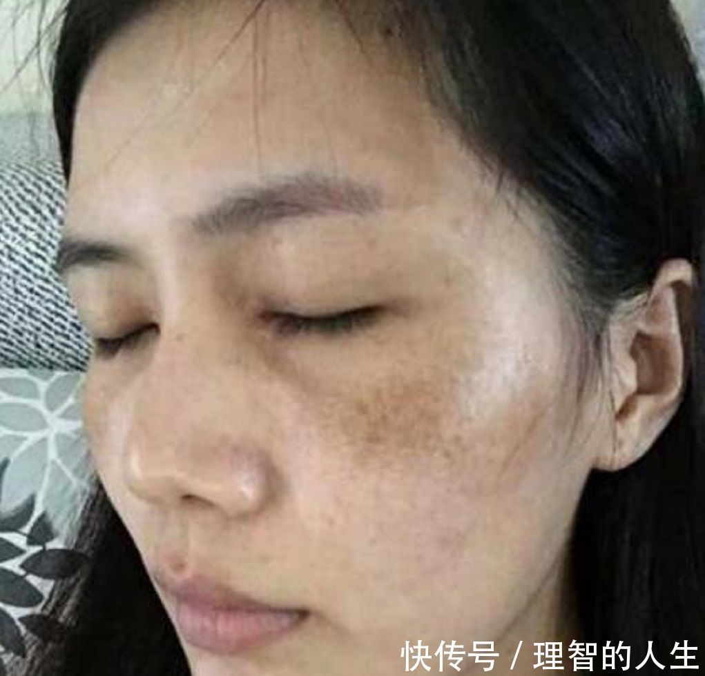  值得■色斑妹子别乱花钱了，用酸奶加它敷脸，美白嫩肤又淡斑，值得收藏