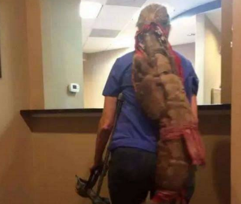 女子10年不洗头不剪头发的人, 咋一看还以为是一条巨型尾巴