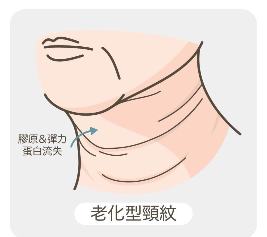 『以很好』从颈纹可以看出年龄?用瑜伽该如何护理?这样练习才专业