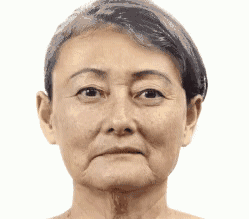  #皮肤#拼命护肤，皱纹还是爬上脸？分层抗衰你了解吗？