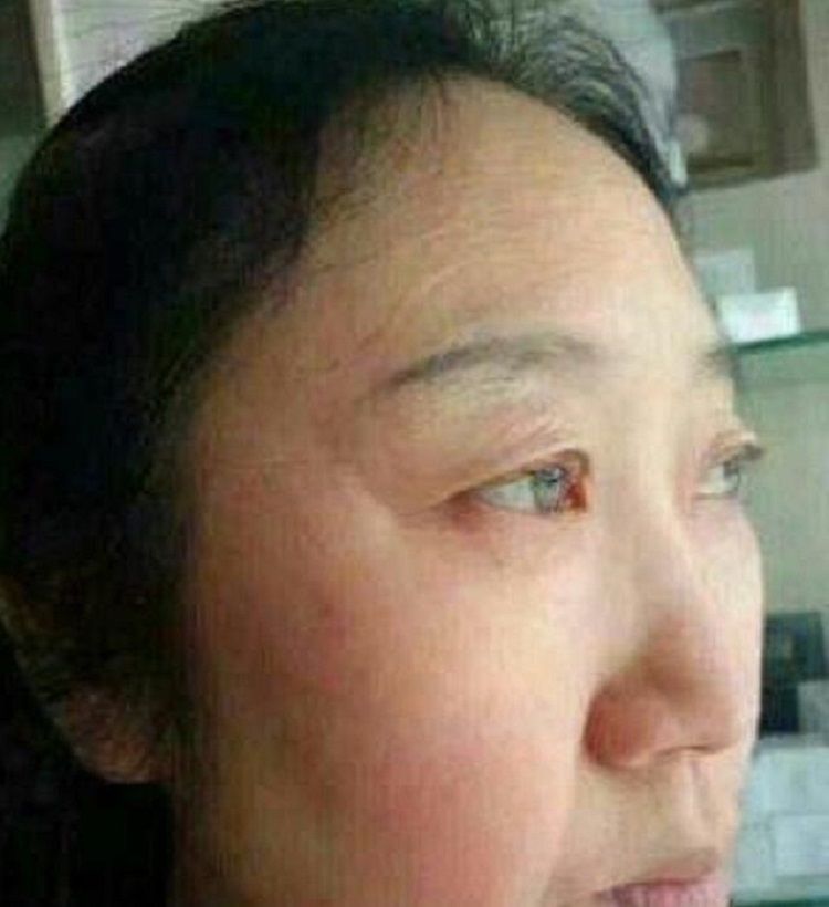 长出“老年斑”别慌张，用了药店的“小药膏”斑不见了脸也变白了