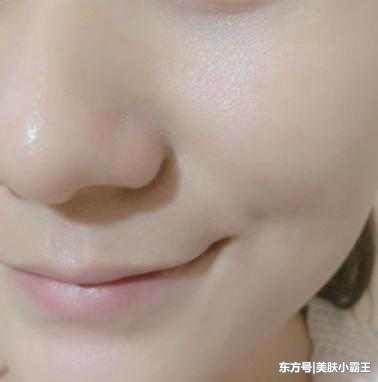 大蒜加“它”, 一周皮肤淡斑紧肤, 去皱增白让你年轻不止5岁