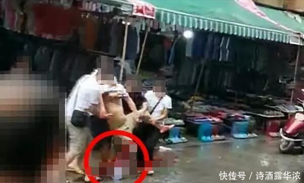 广西男子骗了200多万跑路被砍断脚 警方发布最新通报