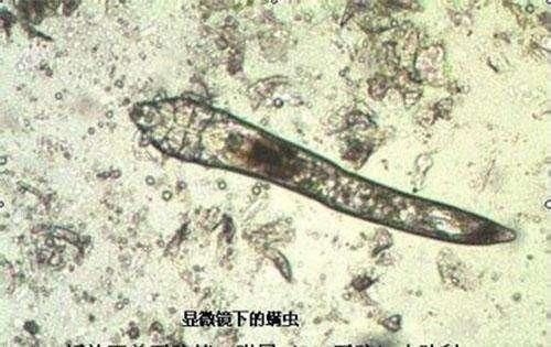 长螨虫期，脸上最明显表现有4点，原是美丽杀手，你有中招吗？