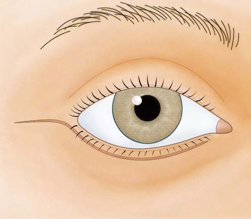 关晓彤跟鹿晗从日本回来，眼袋竟袋消失了？！难道是假眼袋？