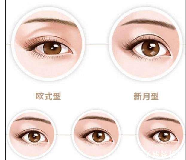  『方人的眼』韩式双眼皮效果如何？与欧式双眼皮区别在哪？