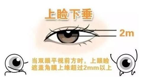  『好看』好看的单眼皮美到离谱！割双眼皮的意义在哪？