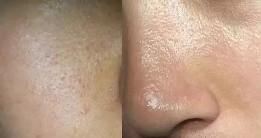 越抹越凉爽,补水不油腻?难怪这款澳洲面霜成为美妆大V的心头肉!