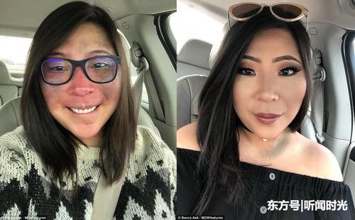 美国女子满脸胎记从小遭歧视,为改变多年苦练化妆术惊艳旁人