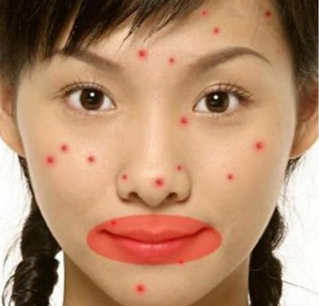 脸上爆痘长黑头,都是螨虫在“怂恿”,2方法快速除螨皮肤变细腻