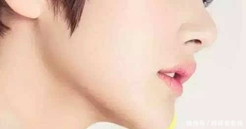 【消肿】自体脂肪丰下巴多久能消肿