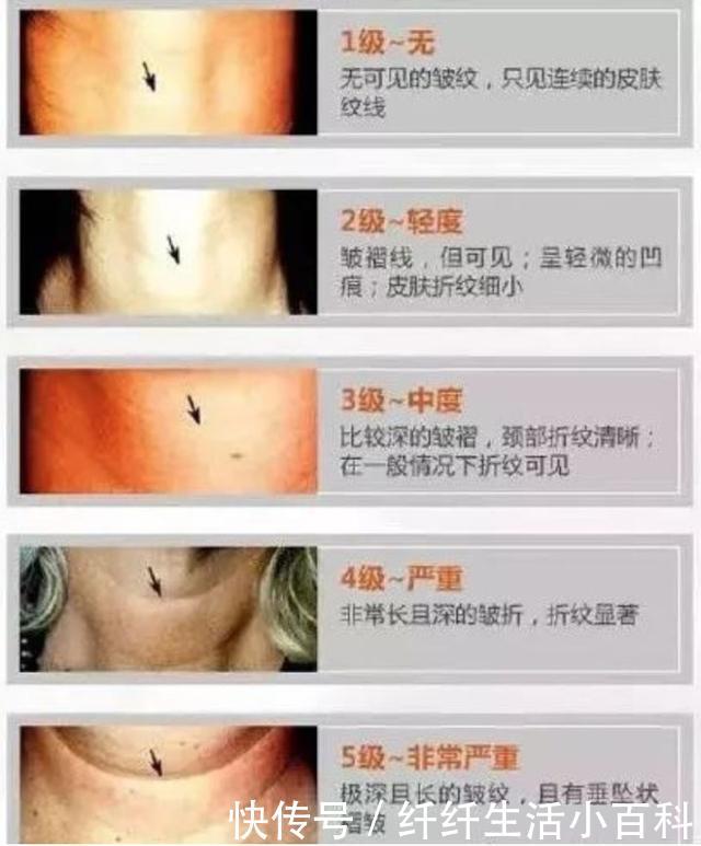 皮肤■18水龄:别让颈纹破坏了你的少女感!