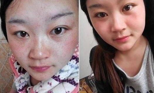 开塞露这样用!聪明的女人每晚抹一下，一周皮肤白皙光滑不反弹