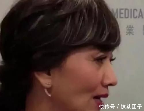 看起来@65岁赵雅芝终于不再装嫩，近照白发稀疏皱纹明显，网友：终于变回老奶奶了