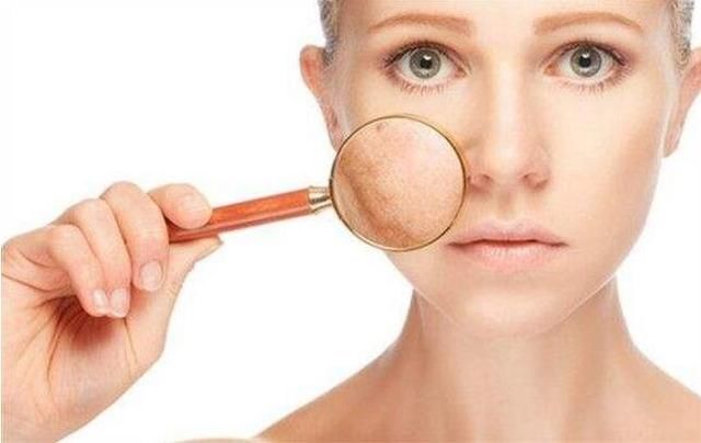 毛孔粗到成小洞，随手一扣都是白色小颗粒，说明内部暗藏过亿螨虫