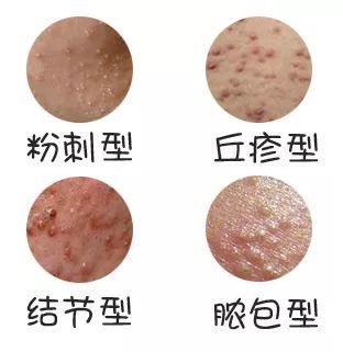 每个女人都希望青春永驻