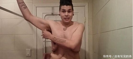 300斤小伙拼命减肥终于成功，而随后发生的事却让他更加烦恼