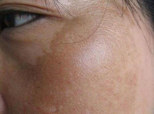 最近很火的一个新妙用,在家里当白醋碰上它,皮肤紧俏白净