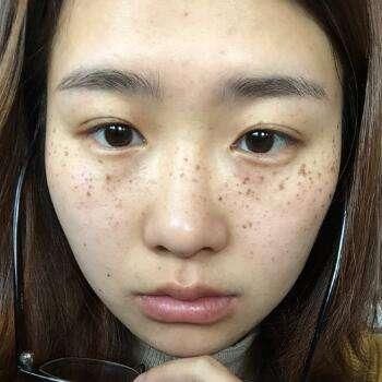 几毛钱搞定的祛斑窍门，特别是第三个，只要学会斑点会彻底远离你