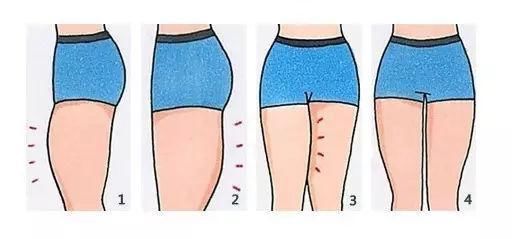 无美腿不夏天!你的腿HOLD住夏天吗?