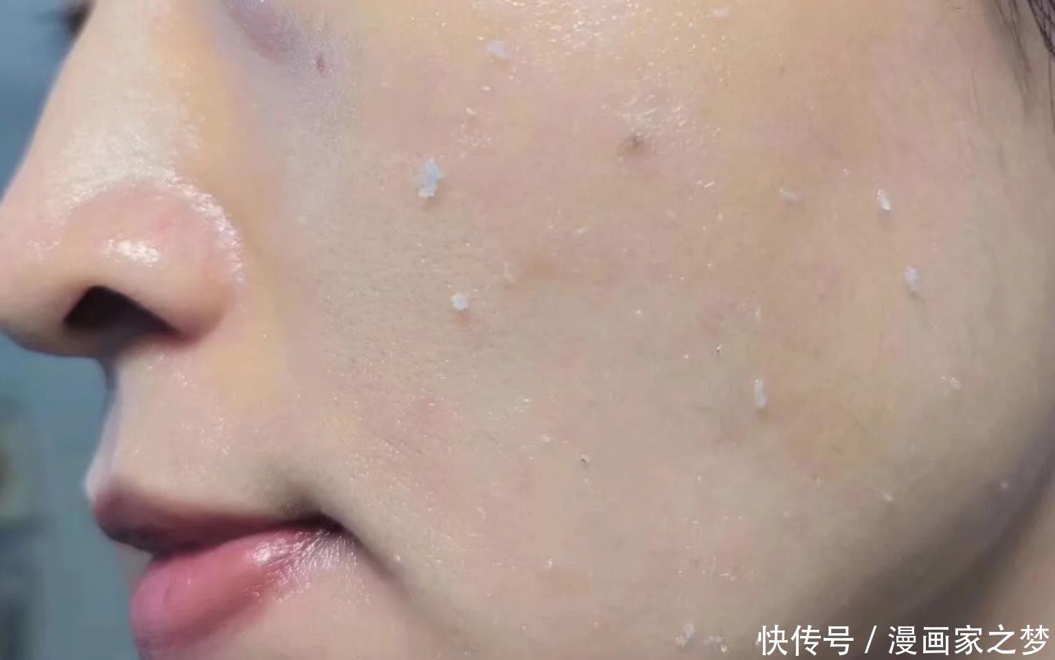  「中招」护肤品一用就搓泥？这几个原因是关键，难怪上千元贵妇精华都中招