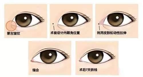  「切口」做完这些医美项目什么时候可以化妆