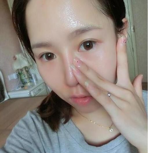 药店几毛钱一只的小白露，睡前用它抹一抹，皮肤白净像20岁