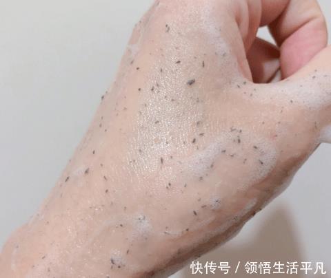 『白色东西』鼻子上挤出来的白色物体是什么皮肤科医生给出这些忠告