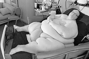 世界最胖男子体重445公斤，用铲车才可以出门，今减肥292公斤!