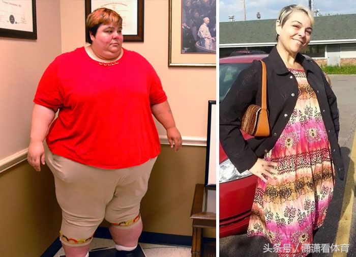 这群体重超过500斤的人仍回归正常，减肥堪比整容!