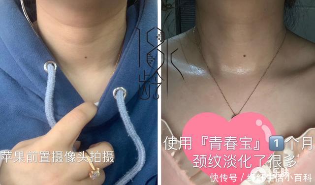  皮肤■18水龄：别让颈纹破坏了你的少女感！