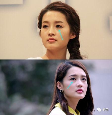 90后的郑爽关晓彤眼袋都要掉地上了，快来个医生救救她们吧!