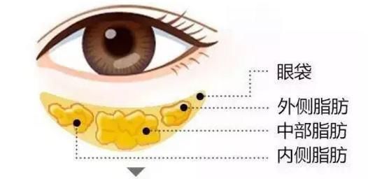  「睑皮肤松弛」眼部美容仪对去眼袋有用吗