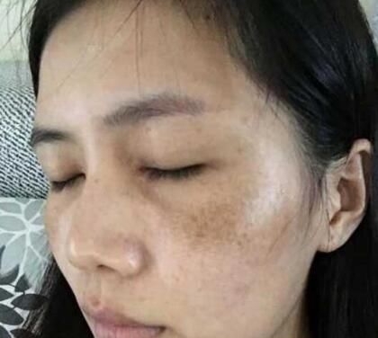 『皮肤不好』淘米水中加点“它”,坚持敷脸半个月,皮肤又白又嫩,色斑都淡了